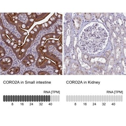 CORO2A Antibody, Novus Biologicals 0.1mL; Unlabeled:Antibodies, Polyclonal